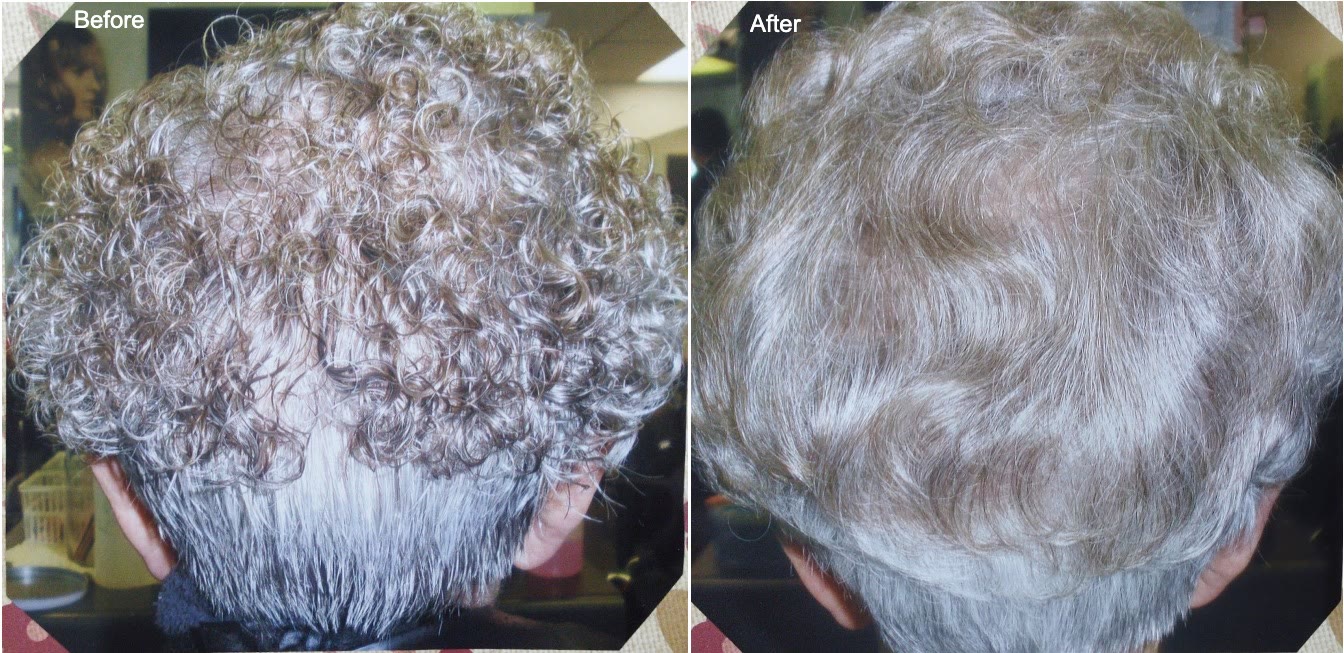 Before and after a basic roller set